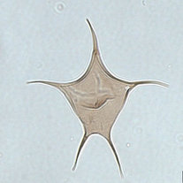 Cyst of Protoperidinium stellatum