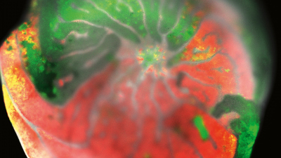 Foraminifera under the fluorescence microscope (Photo: Erik Freier, Leibniz-Institut für Analytische Wissenschaften - ISAS - e.V.)