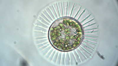 Diatomee Planktoniella sol. 