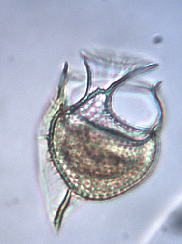 Dinoflagellat Histioneis crateriformis 