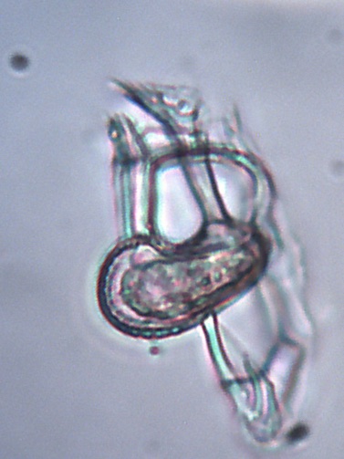 Dinoflagellat Histioneis cymbalaria 