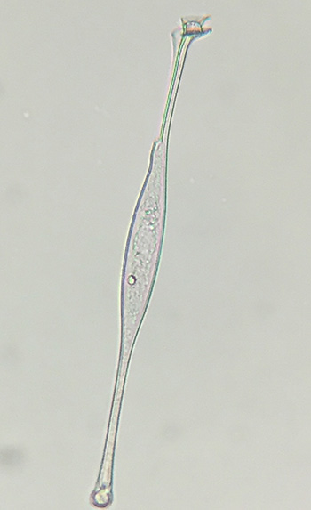 Dinoflagellat Amphisolenia globifera 