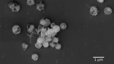 Elektronen-mikroskopische Aufnahme von Lentimonas, einem neu isolierten Bakterium das Fucoidan abbauen kann an. Man sieht, dass die Zellen kleine runde Kokken sind und als Aggregat wachsen. (Foto: Max-Planck-Institut für Marine Mikrobiologie/A. Sichert)