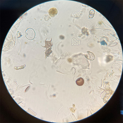 A first look into the microscopic world: after concentrating our samples, we mount a small portion of them on glass slides so that we can identify and count what’s in there. Here you can see different microalgae cells, some already transparent, some still filled with green chloroplasts and therefore more recently deceased. We see diatoms, dinoflagellate cells, and dinoflagellate cysts: the shells left behind by dormant dinoflagellates.
