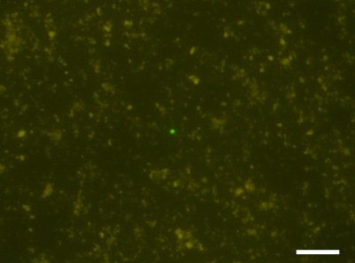 Fluoreszenzmikroskopische Aufnahme von mikrobiellen Zellen im tiefen Unterseeboden. Die Zellen wurden mit einem grünen Fluoreszenzfarbstoff angefärbt. Oben: Mikrobielle Zellen, die aus einer Sedimentkernprobe in einer Tiefe von 652 Meter bei 76 Grad Celsius abgetrennt wurden. Unten: Eine mikrobielle Zelle, die aus einer Sedimentkernprobe in einer Tiefe von 1176,8 Meter bei 120 Grad Celsius nachgewiesen wurde (eine Zelle in der Mitte des Bildes). Die Skala zeigt 20 Mikrometer. Foto: JAMSTEC/IODP