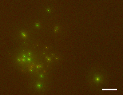 Fluoreszenzmikroskopische Aufnahme von mikrobiellen Zellen im tiefen Unterseeboden. Die Zellen wurden mit einem grünen Fluoreszenzfarbstoff angefärbt. Oben: Mikrobielle Zellen, die aus einer Sedimentkernprobe in einer Tiefe von 652 Meter bei 76 Grad Celsius abgetrennt wurden. Unten: Eine mikrobielle Zelle, die aus einer Sedimentkernprobe in einer Tiefe von 1176,8 Meter bei 120 Grad Celsius nachgewiesen wurde (eine Zelle in der Mitte des Bildes). Die Skala zeigt 20 Mikrometer. Foto: JAMSTEC/IODP