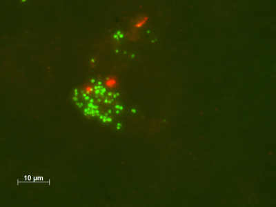 Aufnahme aus dem Epifluoreszenzmikroskop: Methanoliparia-Zellen (grün) aus den Laborkulturen. Das Öltröpfchen, das die Archaeen besiedeln, ist als rötlicher Schimmer zu erkennen. Die roten Punkte sind einige wenig Bakterien, die noch in der Kultur leben. Foto: Rafael Laso-Pérez/Max-Planck-Institut für Marine Mikrobiologie; aus: Zhou et al., Nature, 2021