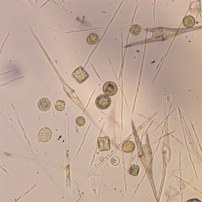 Diatoms and dinoflagellates. Photo: MARUM/ Uni Bremen