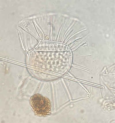 Microscopic image of a tropical dinoflagellate (phytoplankton) recovered from the drifting trap (magnification 1000x). Photo: K. Zonneveld