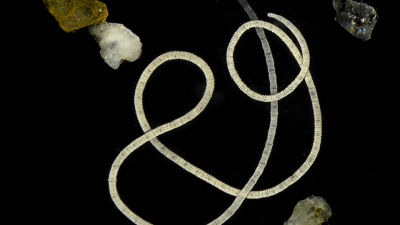 Der darmlose marine Wurm Olavius algarvensis unter dem Mikroskop. Es ist etwa zwei Zentimeter lang und misst nur einen halben Millimeter im Durchmesser. Es lebt zwischen Sandkörnern (im Bild zu erkennen) an Seegraswiesen im Mittelmeer. Foto: Rebekka Jahnke / Max-Planck-Institut für Marine Mikrobiologie
